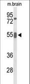 Growth Factor Receptor Bound Protein 7 antibody, LS-C166663, Lifespan Biosciences, Western Blot image 