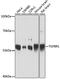 Transforming Growth Factor Beta Receptor 1 antibody, 16-823, ProSci, Western Blot image 