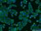 EPS8 Like 2 antibody, 20461-1-AP, Proteintech Group, Immunofluorescence image 