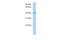 Transmembrane Protein 144 antibody, PA5-69472, Invitrogen Antibodies, Western Blot image 