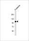Complement Factor B antibody, 63-753, ProSci, Western Blot image 