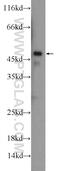 Integrin Linked Kinase antibody, 24926-1-AP, Proteintech Group, Western Blot image 