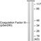 Coagulation Factor III, Tissue Factor antibody, PA5-38458, Invitrogen Antibodies, Western Blot image 