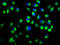 Catenin Alpha 1 antibody, LS-C375544, Lifespan Biosciences, Immunofluorescence image 