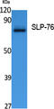 Lymphocyte Cytosolic Protein 2 antibody, STJ96436, St John