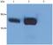 Lymphocyte Cytosolic Protein 2 antibody, GTX14940, GeneTex, Western Blot image 