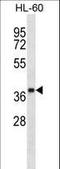 Olfactory Receptor Family 5 Subfamily F Member 1 antibody, LS-C163232, Lifespan Biosciences, Western Blot image 
