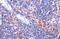 CD81 Molecule antibody, GTX135297, GeneTex, Immunohistochemistry paraffin image 