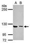 Unc-13 Homolog D antibody, orb73575, Biorbyt, Western Blot image 