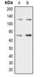 Double-strand-break repair protein rad21 homolog antibody, LS-C368680, Lifespan Biosciences, Western Blot image 