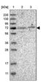 Kelch Like Family Member 20 antibody, PA5-55210, Invitrogen Antibodies, Western Blot image 