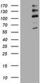 ALK Receptor Tyrosine Kinase antibody, TA801405S, Origene, Western Blot image 