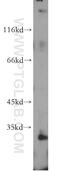 Interleukin 17 Receptor B antibody, 20673-1-AP, Proteintech Group, Western Blot image 