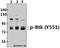 Bruton Tyrosine Kinase antibody, A00245Y551, Boster Biological Technology, Western Blot image 