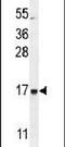 Cilia And Flagella Associated Protein 410 antibody, PA5-24270, Invitrogen Antibodies, Western Blot image 