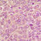 Protein Kinase D1 antibody, LS-C368479, Lifespan Biosciences, Immunohistochemistry paraffin image 