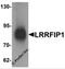 LRR Binding FLII Interacting Protein 1 antibody, 6219, ProSci, Western Blot image 