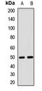 GA Binding Protein Transcription Factor Subunit Beta 1 antibody, LS-C668953, Lifespan Biosciences, Western Blot image 