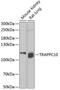 Trafficking Protein Particle Complex 10 antibody, A12033, Boster Biological Technology, Western Blot image 