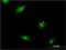 Ribosomal Protein L10 Like antibody, H00140801-M01, Novus Biologicals, Immunocytochemistry image 