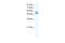 Lysine Demethylase 4D antibody, 28-390, ProSci, Western Blot image 