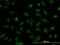 Nucleoporin 133 antibody, H00055746-M01, Novus Biologicals, Immunocytochemistry image 