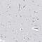 Proteasome Subunit Beta 10 antibody, PA5-56404, Invitrogen Antibodies, Immunohistochemistry paraffin image 