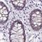 Chromosome Segregation 1 Like antibody, NBP2-38383, Novus Biologicals, Immunohistochemistry paraffin image 