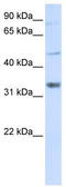 Zinc Finger CCHC-Type Containing 17 antibody, TA341601, Origene, Western Blot image 