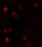 T-Box 21 antibody, GTX31554, GeneTex, Immunocytochemistry image 