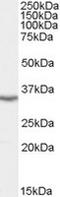 LIM and SH3 domain protein 1 antibody, TA302746, Origene, Western Blot image 