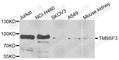 Transmembrane 9 Superfamily Member 3 antibody, A7819, ABclonal Technology, Western Blot image 