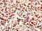 RNA Binding Motif Protein 10 antibody, CSB-PA019400LA01HU, Cusabio, Immunohistochemistry paraffin image 