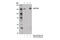 Valosin Containing Protein Interacting Protein 1 antibody, 88153S, Cell Signaling Technology, Immunoprecipitation image 