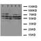 Tachykinin Receptor 1 antibody, LS-C312840, Lifespan Biosciences, Western Blot image 