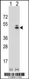 Actin Gamma 1 antibody, 62-306, ProSci, Western Blot image 