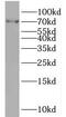 Mevalonate Diphosphate Decarboxylase antibody, FNab05447, FineTest, Western Blot image 