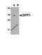 Secreted Phosphoprotein 1 antibody, 7443, ProSci, Western Blot image 