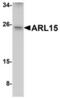 ADP Ribosylation Factor Like GTPase 15 antibody, TA306808, Origene, Western Blot image 