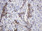 Dolichyl-diphosphooligosaccharide--protein glycosyltransferase subunit 2 antibody, LS-C173877, Lifespan Biosciences, Immunohistochemistry paraffin image 