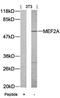 Myocyte Enhancer Factor 2A antibody, orb14453, Biorbyt, Western Blot image 