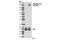 AXL Receptor Tyrosine Kinase antibody, 5724S, Cell Signaling Technology, Western Blot image 