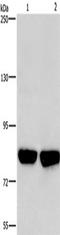 Phosphofructokinase, Platelet antibody, TA349615, Origene, Western Blot image 