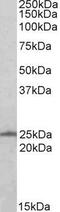 RAN, Member RAS Oncogene Family antibody, GTX17033, GeneTex, Western Blot image 