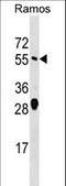 ADP Ribosylation Factor GTPase Activating Protein 2 antibody, LS-C159104, Lifespan Biosciences, Western Blot image 