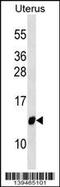 Translocase Of Inner Mitochondrial Membrane 10 antibody, 60-357, ProSci, Western Blot image 