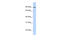 Folate Hydrolase 1 antibody, ARP44691_P050, Aviva Systems Biology, Western Blot image 