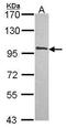 Nuclear cap-binding protein subunit 1 antibody, GTX114570, GeneTex, Western Blot image 