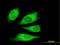 Thyroglobulin antibody, LS-C198336, Lifespan Biosciences, Immunofluorescence image 