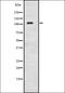 Adenylate Cyclase 2 antibody, orb335103, Biorbyt, Western Blot image 